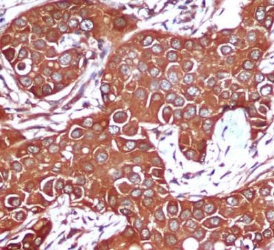 PRKAB1 / AMPK Beta 1 Antibody
