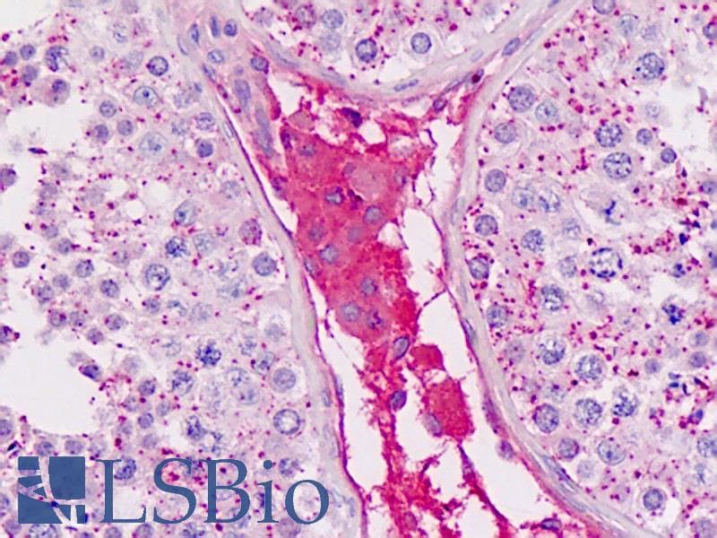 IHC-plus™ Polyclonal Rabbit anti-Human Apolipoprotein A-II Antibody (C-Terminus, IHC, WB)