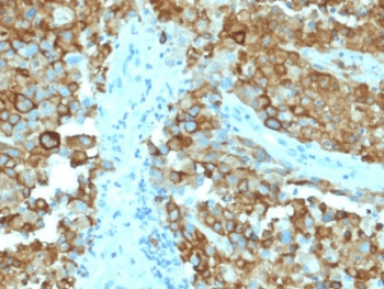 Monoclonal Mouse anti-Human PMEL / SILV / gp100 Antibody (clone PMEL/2038, IHC)