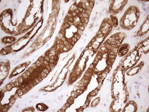 SHMT / SHMT2 Antibody (clone OTI3E9)