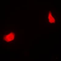 PSMC5 / SUG1 Antibody