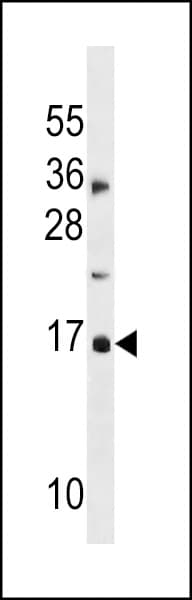 p16INK4a / CDKN2A Antibody (aa1-30)