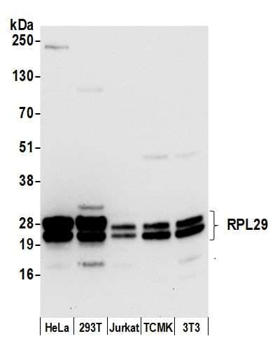 Polyclonal Rabbit anti-Human RPL29 / Ribosomal Protein L29 Antibody (aa109-159, WB)