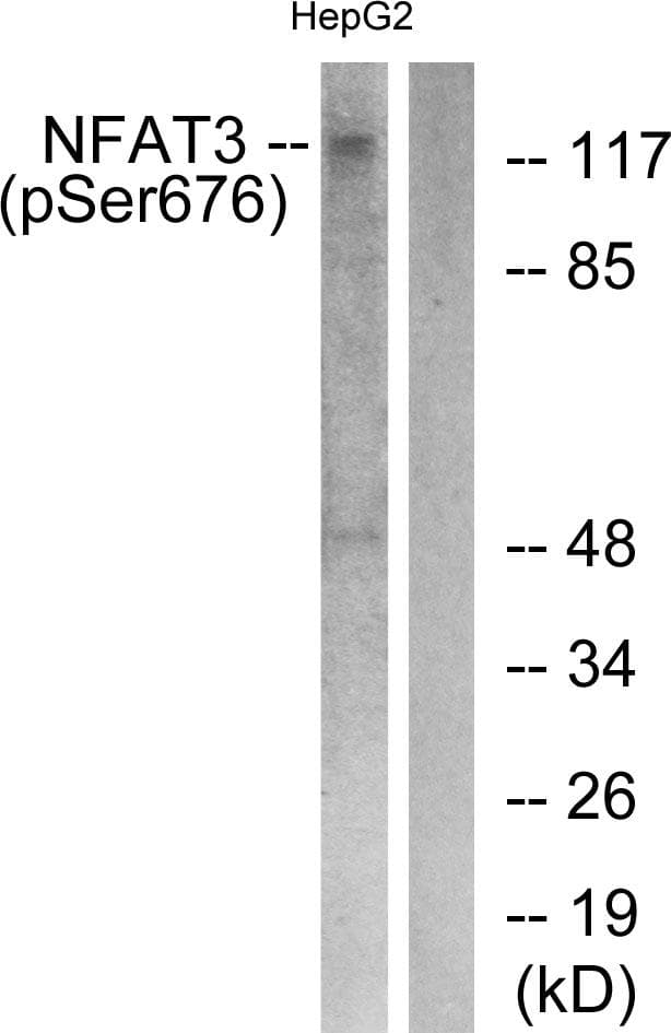 NFATC4 / NFAT3 Antibody (phospho-Ser676)