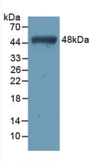TNNC1 / Cardiac Troponin C Antibody (Biotin)