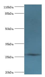 MRDS1 / OFCC1 Antibody (aa3-231)