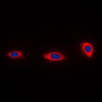 Polyclonal Rabbit anti-Human NDUFA4 Antibody (C-Terminus, IHC, IF, WB)
