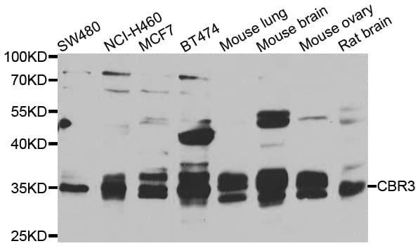 Polyclonal Rabbit anti-Human CBR3 Antibody (IHC, IF, WB)