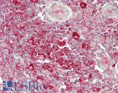 IHC-plus™ RPL26 / Ribosomal Protein L26 Antibody (aa1-50)