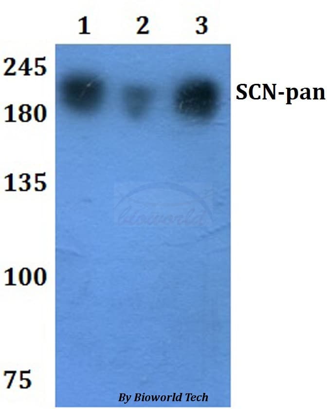 SCN1A / Nav1.1 Antibody