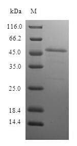 Human PSME1 Protein (Recombinant GST, N-terminus)