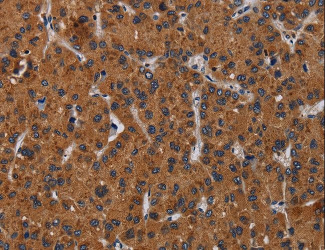 Polyclonal Rabbit anti-Human KLK8 / Kallikrein 8 Antibody (IHC)