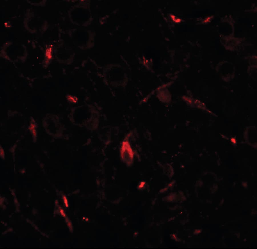 Polyclonal Rabbit anti-Human GRIP1 Antibody (IHC, IF, WB)