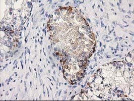 MGLL / Monoacylglycerol Lipase Antibody (clone OTI1A1)