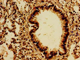 Polyclonal Rabbit anti-Human PTPRF Antibody (IHC)