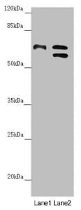 Polyclonal Rabbit anti-Human CDC45 Antibody (IHC, WB)
