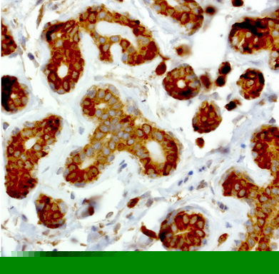 Monoclonal Mouse anti-Human NME1 / NM23 Antibody (clone UMAB94, Carrier-free, IHC, IF, WB)