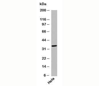 C5AR2 / GPR77 / C5L2 Antibody (N-Terminus)