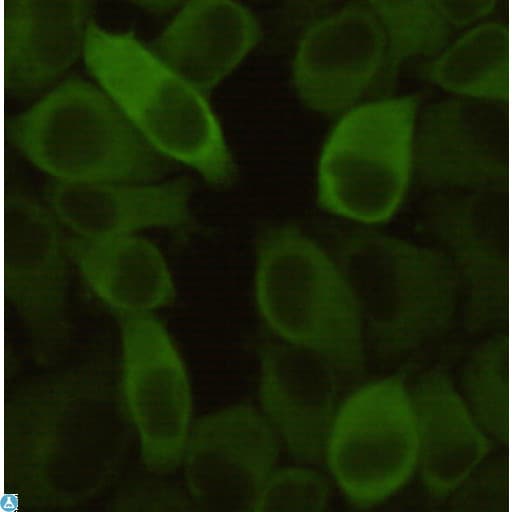 HSPB1 / HSP27 Antibody