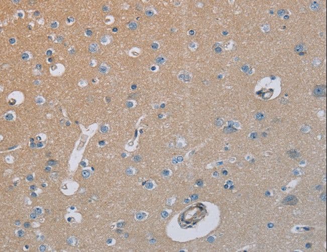 HSD3B7 Antibody