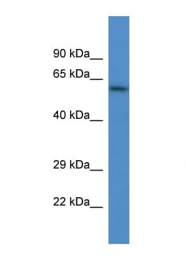 HPSE / Heparanase Antibody (aa68-117)