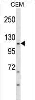 c-Kit / CD117 Antibody