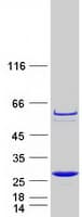 Human PPCDC Protein (Recombinant Myc-DDK (Flag))