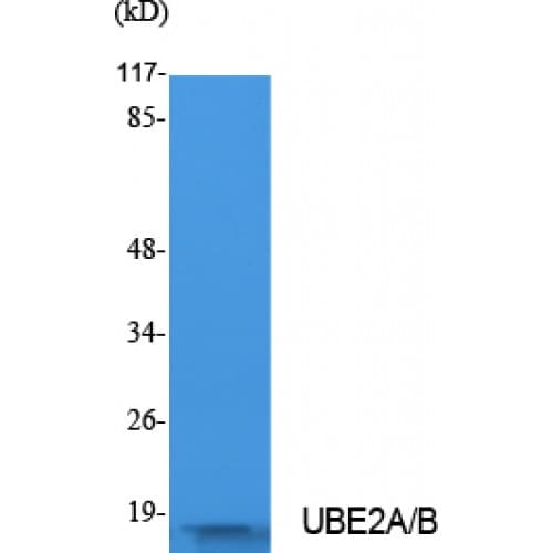 UBE2A+B Antibody (C-terminal)