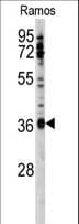 Polyclonal Rabbit anti-Human U2AF1 Antibody (aa55-83, IHC, WB)