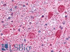 PathPlus™ Polyclonal Rabbit anti-Human GRM1 / MGLUR1 Antibody (C-Terminus, IHC)