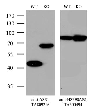 ASS1 / ASS Antibody (C-Terminus, clone OTI12G1)