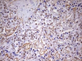 DDX56 Antibody (aa323-547, clone OTI2E5)