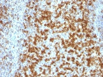 PDCD1 / CD279 / PD-1 Antibody (clone PDCD1/922)