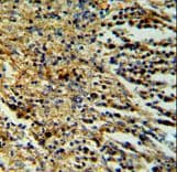 PPP1R18 Antibody (aa192-220)