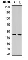 Polyclonal Rabbit anti-Human GABRG2 Antibody (IHC, WB)