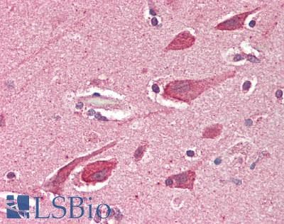 IHC-plus™ BECN2 Antibody