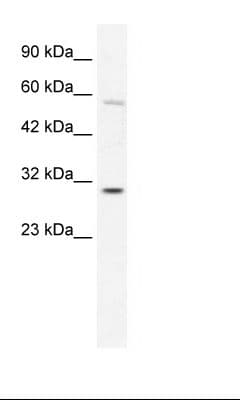 GATAD1 Antibody (C-Terminus)