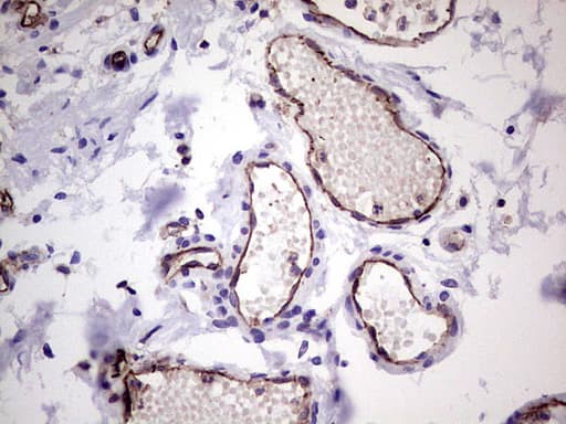 PECAM-1 / CD31 Antibody (clone UMAB164)
