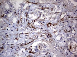 Hamartin / TSC1 Antibody (clone OTI3A2)