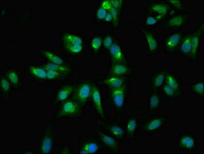 GALT Antibody