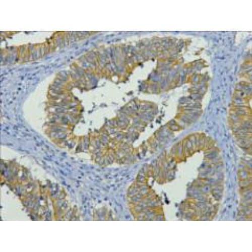 KRT19 / CK19 / Cytokeratin 19 Antibody (clone 11F5)