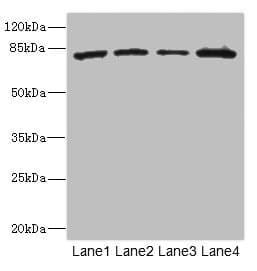 ZP2 Antibody