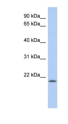 Polyclonal Rabbit anti-Human CHAC2 Antibody (N-Terminus, WB)