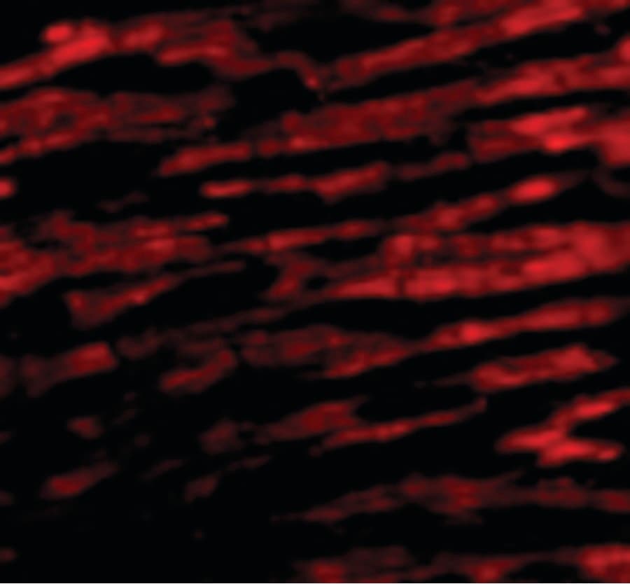 IHC-plus™ BCL2L13 / Bcl Rambo Antibody