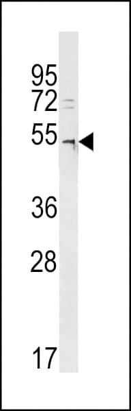 Polyclonal Rabbit anti-Human DCAF12L2 Antibody (aa312-338, WB)
