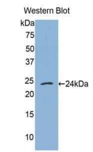 TNFRSF1A / TNFR1 Antibody (aa257-458)