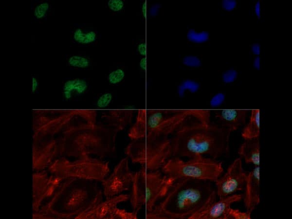 HIST3H3 Antibody (Me3-Lys4/Ac-Lys9)