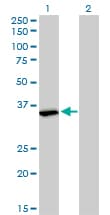 Monoclonal Mouse anti-Human FMR1 / FMRP Antibody (clone 2D4, WB)