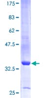 Human SMR3B Protein (Recombinant GST)