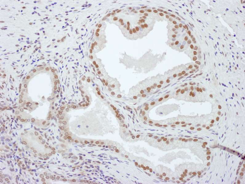 PCYT1A / CCT Alpha Antibody (aa1-50)